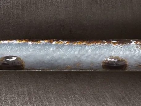 Sanarc Easy 2 comparison