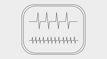Poligrafia respiratoria a domicilio